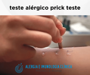 teste alérgico prick teste